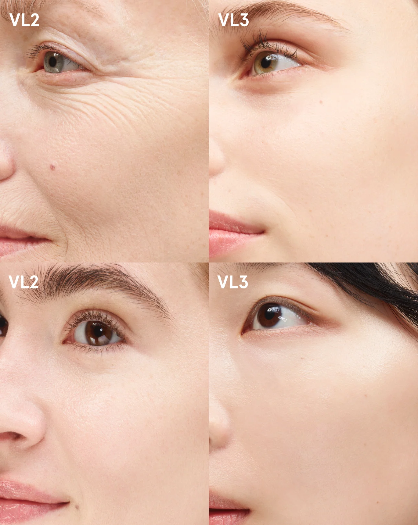 Product image 215